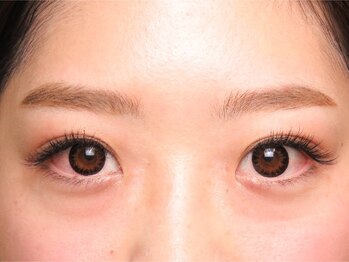 ルプラス(LUPLUS)/◆正面からの見え方◆