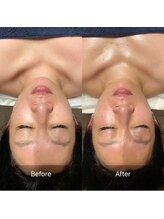 リュミエール デスポワール(lumiere d'espoir)/アロマリンパと小顔コルギコラボ