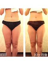 バービーホリック(barbie holic)/１３０分コース　初回と10ヶ月後