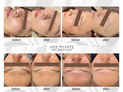 アン ビューティー(ann beauty)の写真
