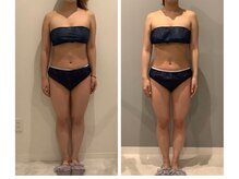 美容整骨小顔ラボ/ハイパーナイフ痩身