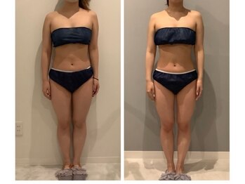 美容整骨小顔ラボ/ハイパーナイフ痩身