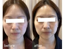 レアビューティー(Le'a beauty)/サーマトリックス×レモンボトル