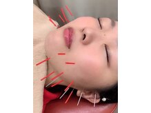森脇鍼灸整骨院 吹田本院