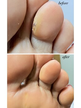 ラヴィ(La vie)/指にもタコ