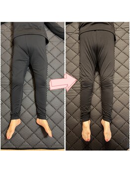 リ リーフ(Re.leaf)/【ビフォーアフター】