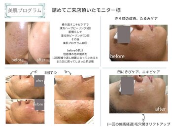 ベルスタイル(Bell style)/当店のお客様症例(凸凹)