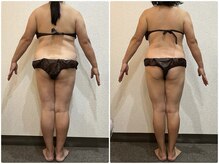 美容整体 ウェリナ 蟹江院/小顔矯正/骨盤矯正/痩身整体