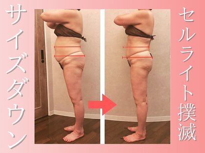 ドルチェエフェクト(dolce effect)の写真