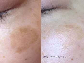 ボタニック 福津店(BoTANiC)