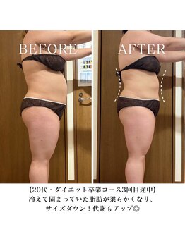 ヨサパーク サンテ 祐天寺(YOSA PARK sante)/痩身/ダイエット/よもぎ蒸し痩身