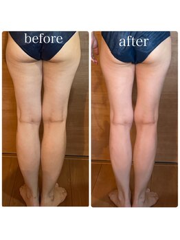 カレント(current)/筋膜リリース《足集中》¥7000