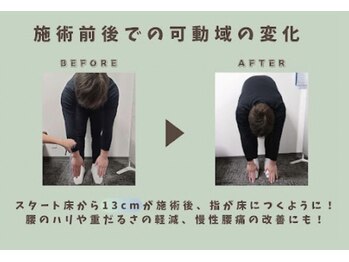STRETCH LIVERA 北千住店/ストレッチ リヴェラ/施術前後での可動域の変化