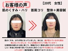 サロンスマイル/20代美容鍼ビフォーアフター
