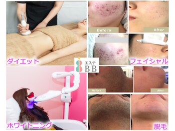 セルフエステBB あけのアクロス店