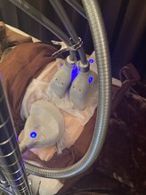 ブルースター(Blue Star)/脂肪冷却4カップ施術風景