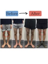 ステイゴールド美容整体院(STAY GOLD)/O脚矯正の効果