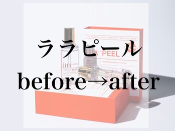 ジョアアンジェ 京橋店(joie ange)/ララピール