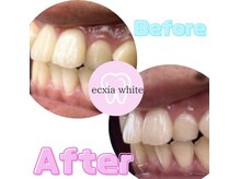 エクシアホワイト SOKA(ecxia white)/