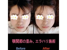 美容矯正サロン レレポノ(LELEPONO)/