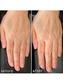 ネイルズ アヴァンティ(Nails Avanti)/ネイルケア&ハンドケア