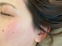 アッベリーナ ラシン 東津田店(abbellina×Racin)