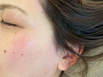 アッベリーナ ラシン 東津田店(abbellina×Racin)の写真/【毛穴ケア★お肌のお悩み解決！】幅広い世代に人気の美肌フェイシャルワックスでツルスベ美顔に♪