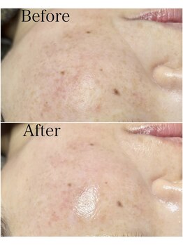 ブラックボックス(BLACK BOX)/40代女性のお客様