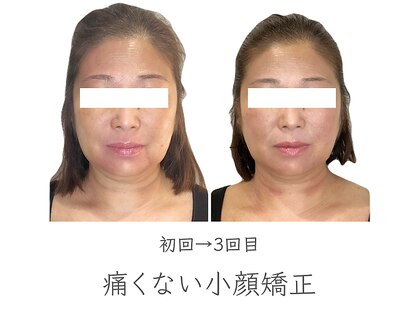 ゆずのはなの写真