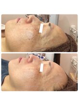 ラディエンス 多治見店/マーメイドセルエステ