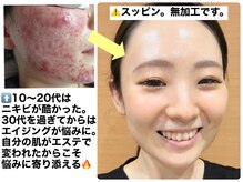スイ(sui)の雰囲気（悩んだからこそお客様に寄り添い、結果にこだわります。天久保）