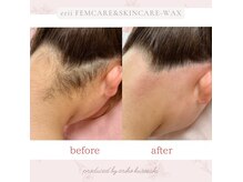 エリィ ワックス(erii wax)の雰囲気（大人気のうなじのワックス♪とてもスッキリとして清潔感アップ！）