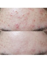 ソアン(Soin)/諦めないで！