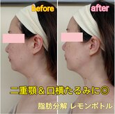 シャトン ボーテ(chaton beaute)