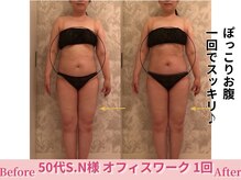 アメリイ 百合ヶ丘 新百合ヶ丘(Amerii)/【50代痩身】スッキリお腹！