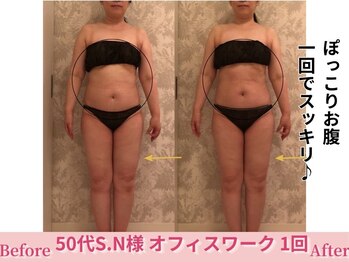 アメリイ 百合ヶ丘 新百合ヶ丘(Amerii)/【50代痩身】スッキリお腹！