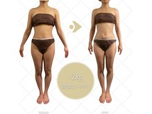 エムズ ビューティー サロン(M's Beauty Salon)の雰囲気（痩身/ダイエット/表参道/青山/渋谷/美脚/くびれ/下半身/セル脂肪）