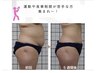 凄腕担当/40代必見/痩せにくい落ちない脂肪/慢性的むくみ最新ボディ形成