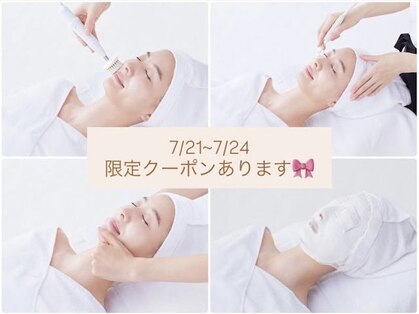 アイオンの写真