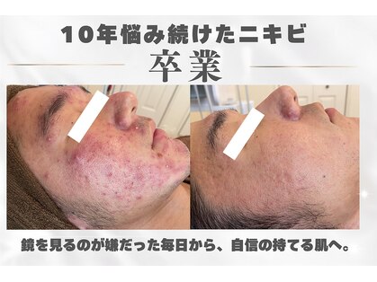 ポアレ(POARE)の写真