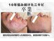ポアレ(POARE)の写真