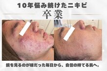 ポアレ(POARE)