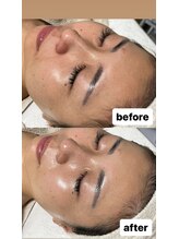 ルアラナ(Lualana)/カサカサ乾燥やデリケート肌には