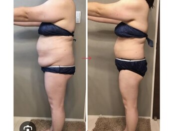 グランデココ(GRANDE COCO)/ダイエットコース3ヶ月