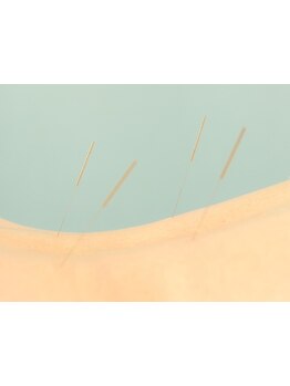 腰のつらさを改善したい