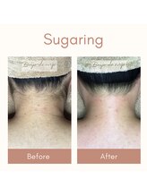 ベイジョ デ アンジョ(Beijo de anjo)/うなじシュガーリング