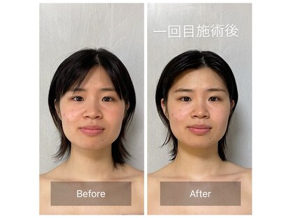 リエル(Riele)の写真