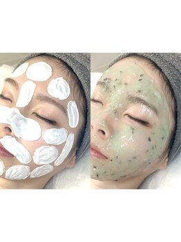 顔脱毛がしたい