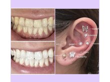 シード(SHE°)/耳ツボジュエリーホワイトニング