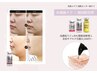 【小顔たるみケア】脂肪分解成分高圧ジェット注入 初回お試し16500円